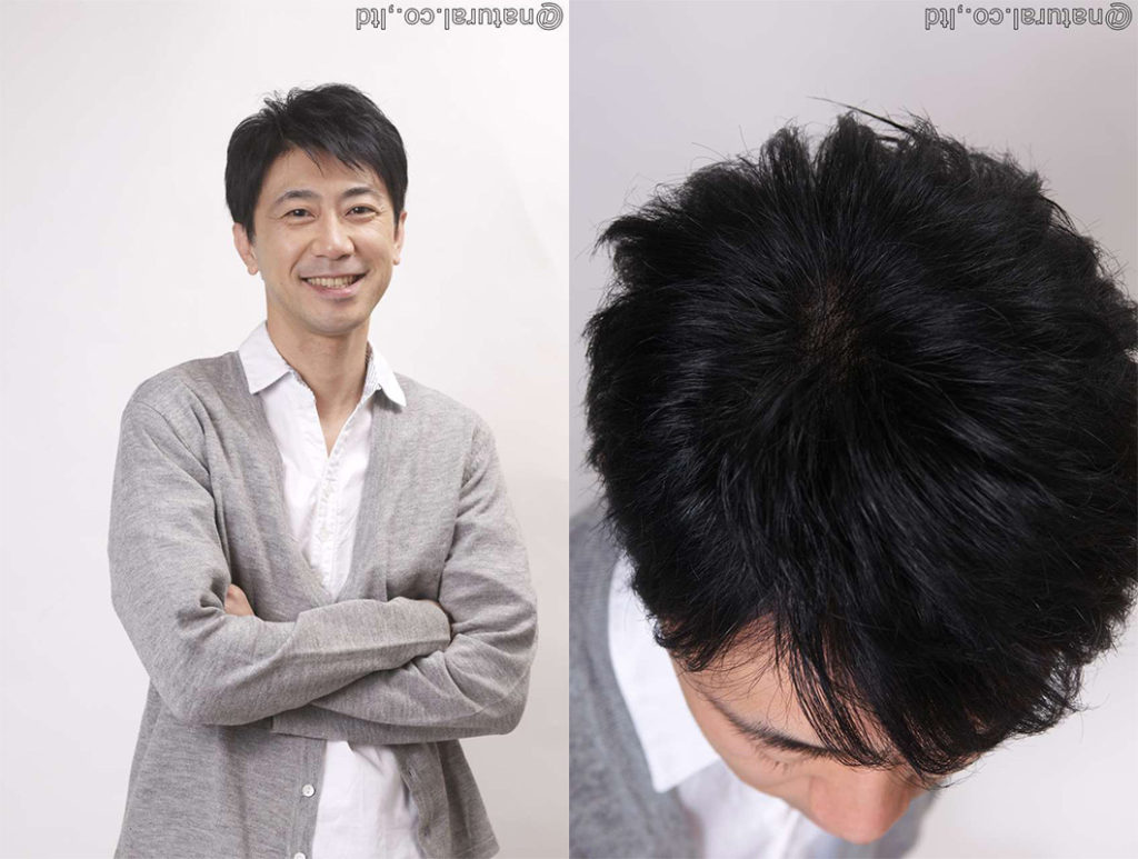 フルオーダーウィッグ男性の装着写真