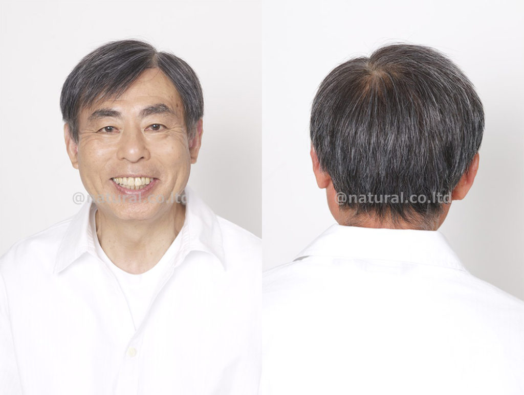 フルオーダーウィッグ男性の装着写真