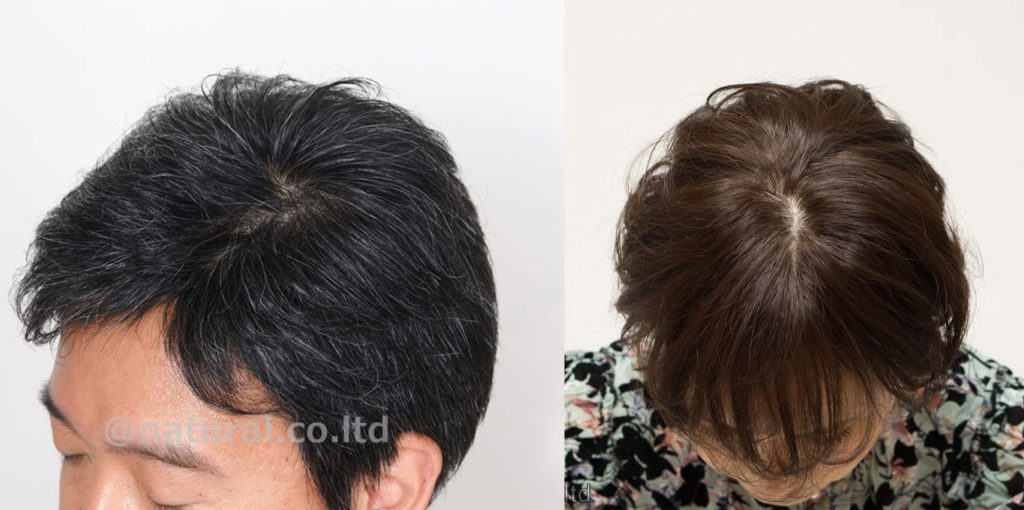 スキンフェイスの画像