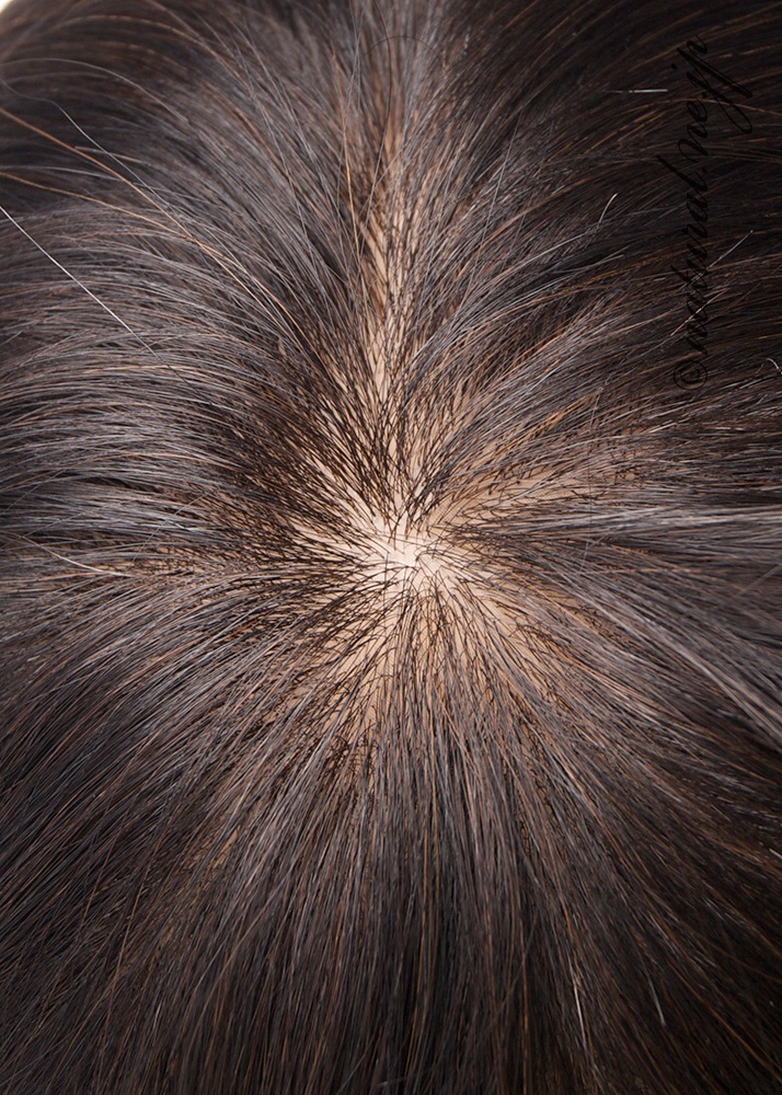 スキンフェイスの詳細画像